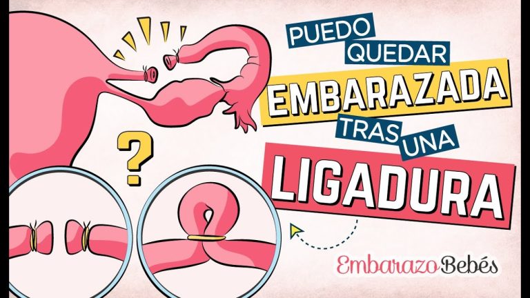 Puedo Quedar Embarazada Con Ligadura De Trompas Actualizado Septiembre 2024 8579