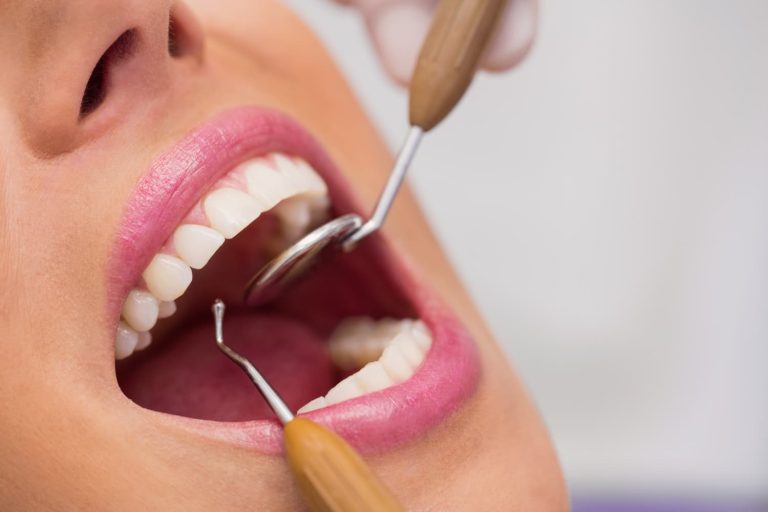La importancia de acudir al dentista con regularidad